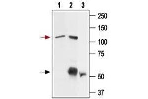 Immunoprecipitation of rat basophilic leukemia (RBL) cell lysate: - 1. (TRPV2 anticorps  (1st Extracellular Loop))
