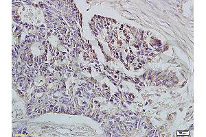 Immunohistochemistry (IHC) image for anti-HLA Class I Histocompatibility Antigen, alpha Chain E (HLA-E) (AA 251-358) antibody (ABIN674334)