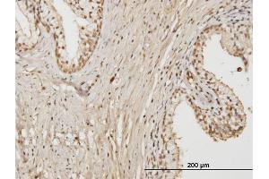 Immunoperoxidase of monoclonal antibody to RAB17 on formalin-fixed paraffin-embedded human prostate.