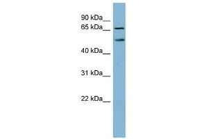 MYST1 antibody used at 1 ug/ml to detect target protein. (MYST1 anticorps  (N-Term))