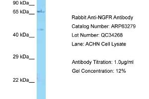 Western Blotting (WB) image for anti-Nerve Growth Factor Receptor (NGFR) (C-Term) antibody (ABIN2789433) (NGFR anticorps  (C-Term))
