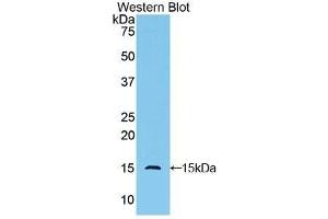 Detection of Recombinant GLG1, Human using Polyclonal Antibody to Golgi Glycoprotein 1 (GLG1)