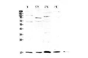 Western blot analysis of IL1F10 using anti-IL1F10 antibody . (IL1F10 anticorps  (AA 1-152))