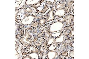 IHC analysis of SNRPD2 using anti-SNRPD2 antibody (ABIN7598963). (SNRPD2 anticorps  (AA 1-118))