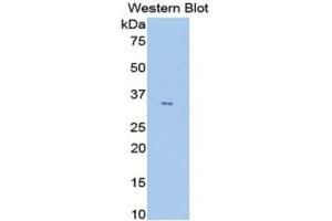 WB of Protein Standard: different control antibodies against Highly purified E. (ANGPTL4 Kit ELISA)