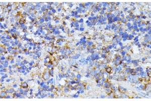 Immunohistochemistry of paraffin-embedded Mouse spleen using CAD Polyclonal Antibody at dilution of 1:100 (40x lens).