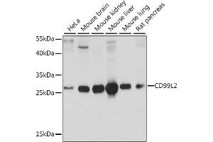 Western blot analysis of extracts of various cell lines, using CD99L2 antibody (ABIN7266229) at 1:1000 dilution. (CD99L2 anticorps  (AA 26-185))
