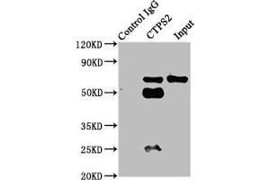 Immunoprecipitating CTPS2 in HepG2 whole cell lysate Lane 1: Rabbit control IgG instead of ABIN7148718 in HepG2 whole cell lysate. (CTPS2 anticorps  (AA 62-315))