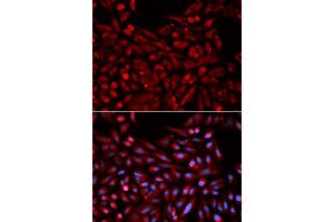 Immunofluorescence analysis of U2OS cells using NR1I3 antibody. (NR1I3 anticorps)