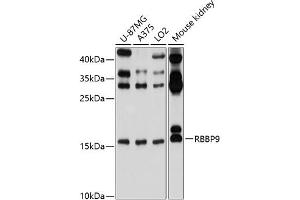 Western blot analysis of extracts of various cell lines, using RBBP9 antibody (ABIN6129095, ABIN6146752, ABIN6146753 and ABIN6220638) at 1:1000 dilution. (RBBP9 anticorps  (AA 1-186))