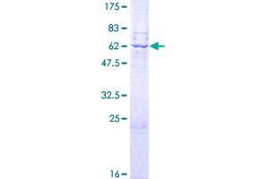 Acid Phosphatase 5, Tartrate Resistant (ACP5) (AA 1-325) protein (GST tag)