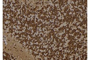 ABIN6277502 at 1/100 staining Rat brain tissue by IHC-P.