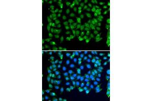 Immunofluorescence analysis of MCF-7 cells using RNF8 antibody. (RNF8 anticorps)