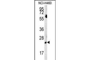 Western blot analysis in NCI-H460 cell line lysates (15ug/lane). (EBPL anticorps  (C-Term))