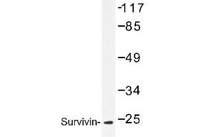 Image no. 1 for anti-Baculoviral IAP Repeat-Containing 5 (BIRC5) antibody (ABIN272115) (Survivin anticorps)