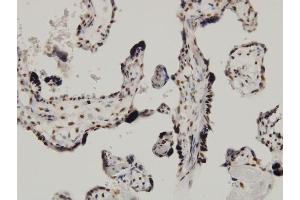 anti-CDKN2A Interacting Protein (CDKN2AIP) (AA 1-579) antibody