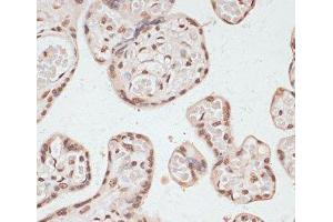 Immunohistochemistry of paraffin-embedded Human placenta using Phospho-PRKAA1(T183)/PRKAA2(T172) Polyclonal Antibody at dilution of 1:100 (40x lens). (PRKAA1 anticorps  (pThr172, pThr183))