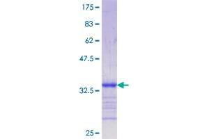 Image no. 1 for Low Density Lipoprotein Receptor-Related Protein 5 (LRP5) (AA 41-130) protein (GST tag) (ABIN1309738)