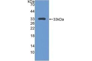Detection of Recombinant CENPH, Mouse using Polyclonal Antibody to Centromere Protein H (CENPH) (CENPH anticorps  (AA 28-241))