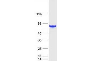 Validation with Western Blot