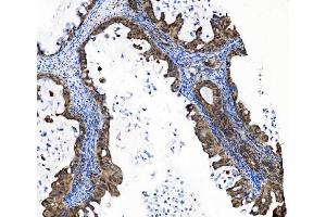 IHC analysis of PRDM14 using anti-PRDM14 antibody (ABIN7603152).