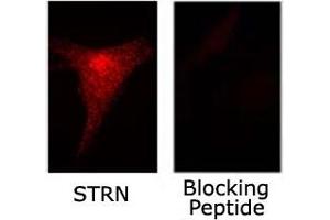 Immunofluorescence staining of STRN on NIH/3T3 cells with or without blocking peptide with STRN polyclonal antibody . (Striatin anticorps)