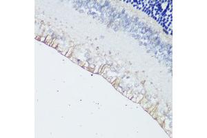 Immunohistochemistry of paraffin-embedded rat retina using OPN4 antibody (ABIN7269103) at dilution of 1:200 (40x lens). (OPN4 anticorps  (AA 365-489))
