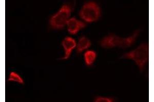 ABIN6274952 staining HuvEc by IF/ICC. (CHST10 anticorps  (Internal Region))