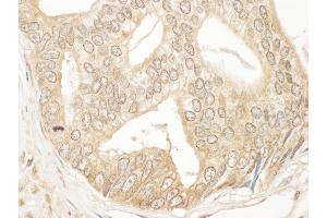 Immunohistochemistry (IHC) image for anti-Mitogen-Activated Protein Kinase Kinase 2 (MAP2K2) (AA 1-50) antibody (ABIN7453730)