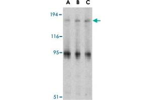 Western blot analysis of IRS1 in PC-3 cell lysate with IRS1 polyclonal antibody  at (A) 1, (B) 2 and (C) 4 ug/mL . (IRS1 anticorps  (Internal Region))