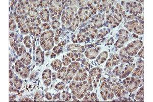 Image no. 2 for anti-Retinoic Acid Receptor Responder (Tazarotene Induced) 1 (RARRES1) antibody (ABIN1500600)