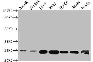 Western Blot Positive WB detected in: HepG2 whole cell lysate, Jurkat whole cell lysate, PC-3 whole cell lysate, K562 whole cell lysate, HL-60 whole cell lysate, Mouse Brain whole cell lysate, Rat Brain whole cell lysate All lanes: GSTP1 antibody at 1:1000 Secondary Goat polyclonal to rabbit IgG at 1/50000 dilution Predicted band size: 24 kDa Observed band size: 24 kDa (Recombinant GSTP1 anticorps)