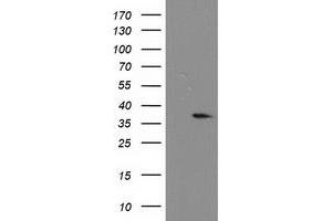 Western Blotting (WB) image for anti-Nucleotide Binding Protein-Like (NUBPL) (AA 1-250) antibody (ABIN1490631) (NUBPL anticorps  (AA 1-250))