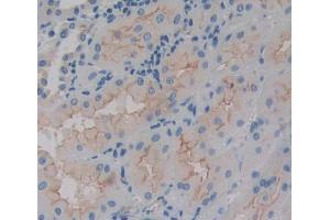IHC-P analysis of Human Tissue, with DAB staining. (ABCA4 anticorps  (AA 1398-1727))