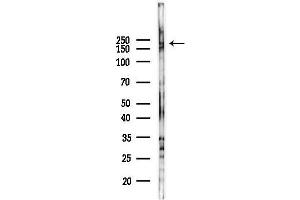 Western blot analysis of lysates from PC12 cells(LPS 4h treatment), using TRPM7 Antibody at 1/1000 dilution.