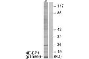 Western blot analysis of extracts from Jurkat cells treated with EGF 200ng/ml 30', using 4E-BP1 (Phospho-Thr69) Antibody. (eIF4EBP1 anticorps  (pThr69))