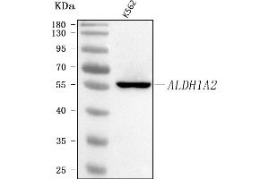 Western blot analysis of ALDH1A2 using anti-ALDH1A2 antibody (ABIN7599264).
