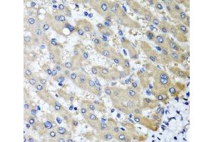 Immunohistochemistry of paraffin-embedded Human liver damage using RBP2 Polyclonal Antibody at dilution of 1:100 (40x lens). (RBP2 anticorps)
