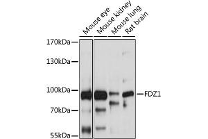 Western blot analysis of extracts of various cell lines, using FZD1 antibody (ABIN6131659, ABIN6140836, ABIN6140837 and ABIN6214992) at 1:1000 dilution. (FZD1 anticorps  (AA 210-320))