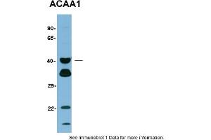 Sample Type: Human LiverPrimary Dilution: 1:1000Gel concentration: 12% (ACAA1 anticorps  (N-Term))