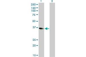 Western Blot analysis of ZFP36L1 expression in transfected 293T cell line by ZFP36L1 monoclonal antibody (M02), clone 1A3.