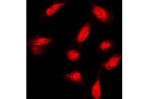 Immunofluorescent analysis of c-FER staining in HeLa cells.