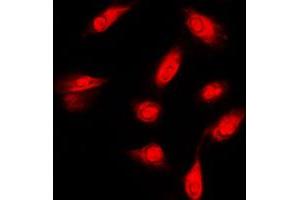 Immunofluorescent analysis of c-FER staining in HeLa cells. (FER anticorps  (C-Term))