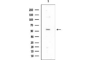 anti-ELAC1 (ELAC1) antibody