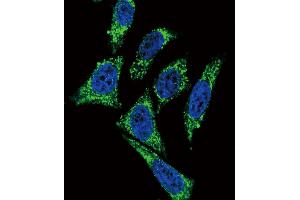 anti-Midkine (Neurite Growth-Promoting Factor 2) (MDK) (AA 113-143), (C-Term) antibody