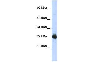 WB Suggested Anti-UBE2L3 Antibody Titration:  0. (UBE2L3 anticorps  (Middle Region))