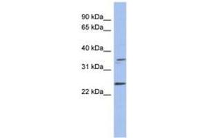 Image no. 1 for anti-Necdin Homolog (Mouse) (NDN) (AA 179-228) antibody (ABIN6744060) (NDN anticorps  (AA 179-228))