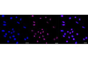 anti-N-Acetyltransferase 10 (GCN5-Related) (NAT10) antibody