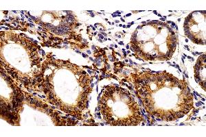 Detection of EPCAM in Porcine Colon Tissue using Polyclonal Antibody to Epithelial Cell Adhesion Molecule (EPCAM) (EpCAM anticorps  (AA 25-265))