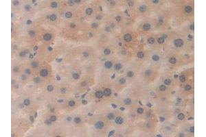 DAB staining on IHC-P; Samples: Mouse Liver Tissue (APP anticorps  (AA 672-711))